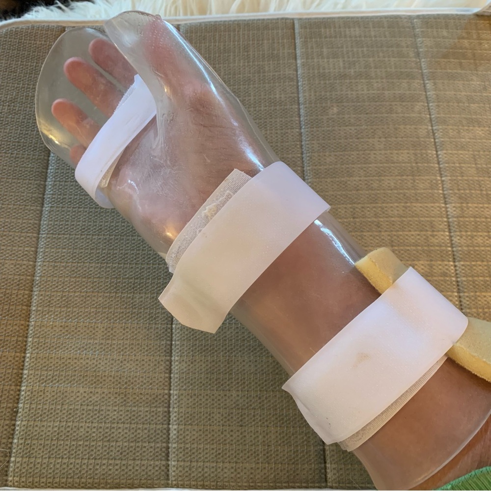 Wrist splint,  arthritis trainer, stroke trainer